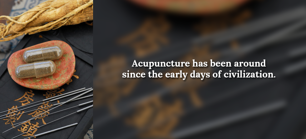 Acupuncture Has Been Used
